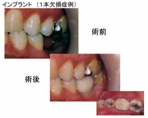 �C���v�����g�C���[�W