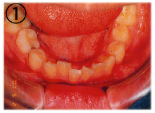 ��������1