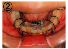 ��������2