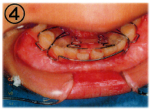 ��������4