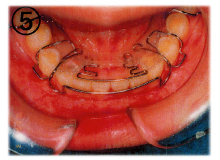 ��������5