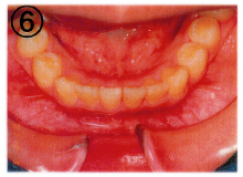 ��������6