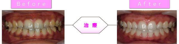 �z���C�g�j���O�C���[�W